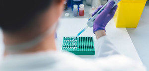 Citoliva aportará su experiencia en innovación en la industria oleícola para el desarrollo de nuevos alimentos